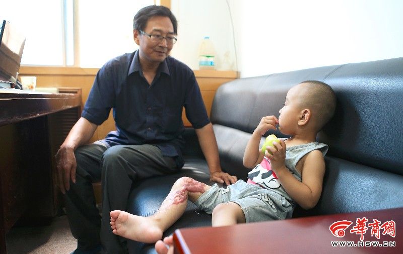 西安2岁男童烫伤没钱治 手术拖延恐影响走路  