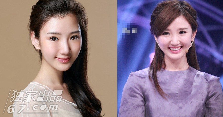 颜值界的一股清流 女星婴儿肥胜过网红锥子脸
