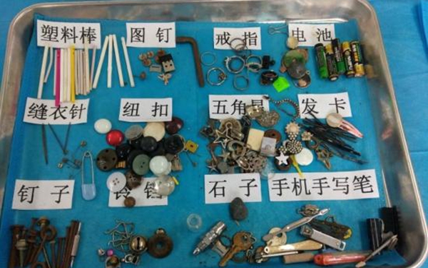 你能相信吗 这都是西安的孩子们吞下过的东西