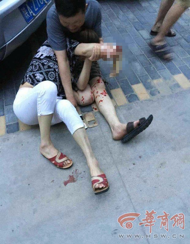 西安大风刮掉屋顶铁皮 过路女手腕几乎被割断