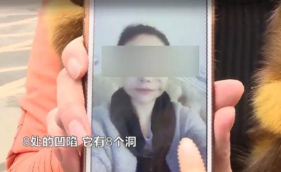 女子脸整容整出8个坑 整形机构:想要美先变鬼