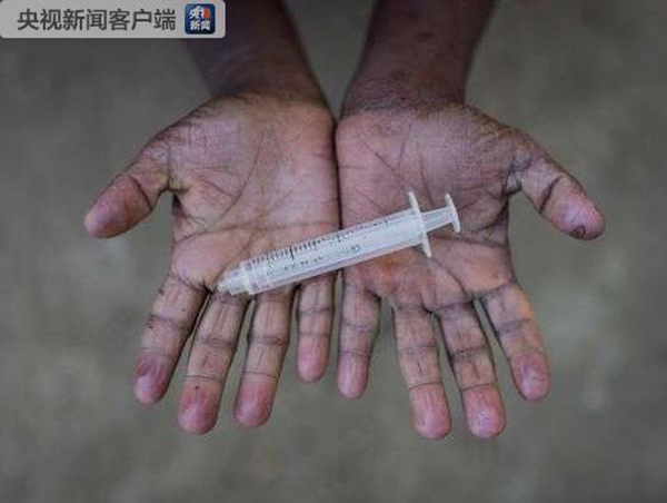 印度冒牌医生一支针头给多人注射 至少33人感染HIV