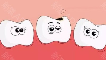 牙齿根部烂了是怎么回事 应该怎么办？