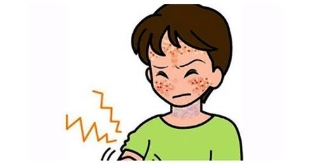 皮肤过敏不要不当一回事 小心诱发这5种并发症