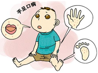 儿童手足口病有哪些症状 应做好3大措施来预防！