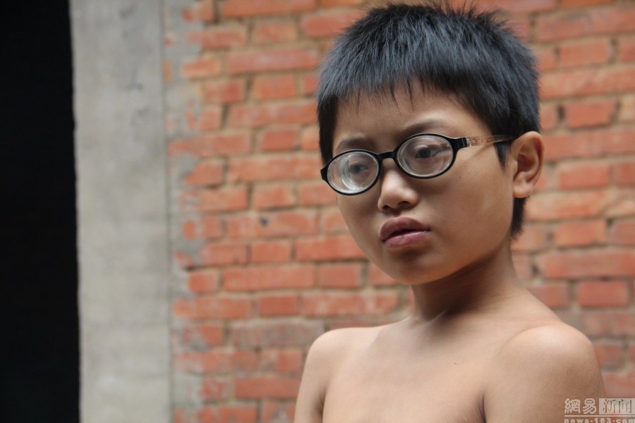 河南男孩自小近视2000度 不知道亲妈长啥样|男孩|护士-社会新闻_华商
