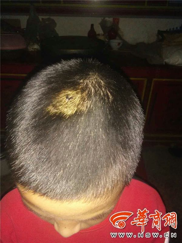 儿子被校门上琉璃瓦砸破头 商洛母亲送医途中被车撞亡