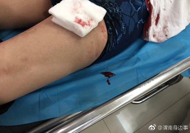 渭南城管队员执法受阻被捅伤已紧急送医