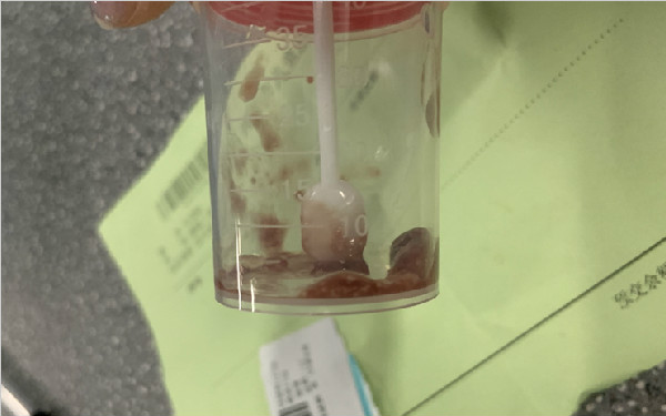 西安2女生叫外卖用餐后上吐下泻 商家承担医药费并赔偿3000元