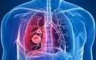 华商头条|肺炎刷屏!15名医护人员感染